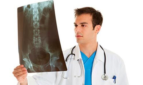 ārsts izskata rentgenu, lai diagnosticētu jostas sāpes